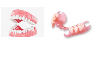 Complete Dentures vs Partial Dentures
